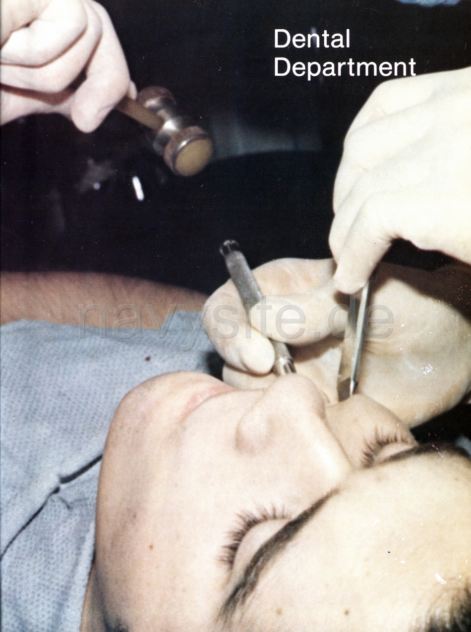 1979:04:05